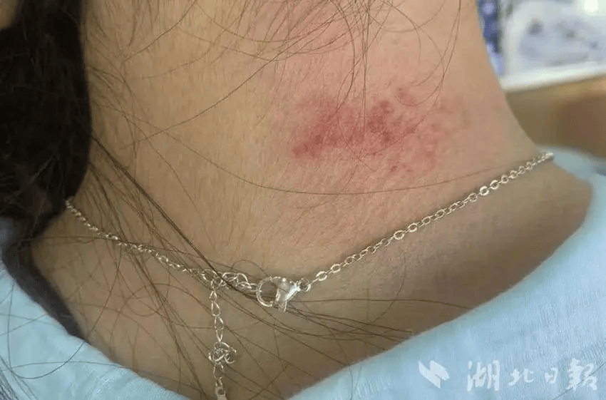 属超标！扬州人快自查……AG真人登录这种
